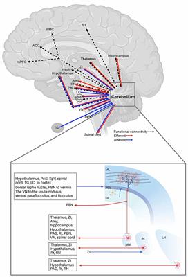 Involvement of the cerebellum in migraine